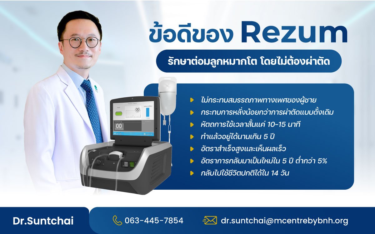 ข้อดีของ rezum