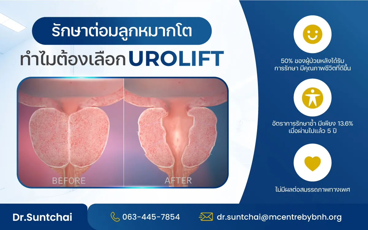 urolift-berfore-and-after
