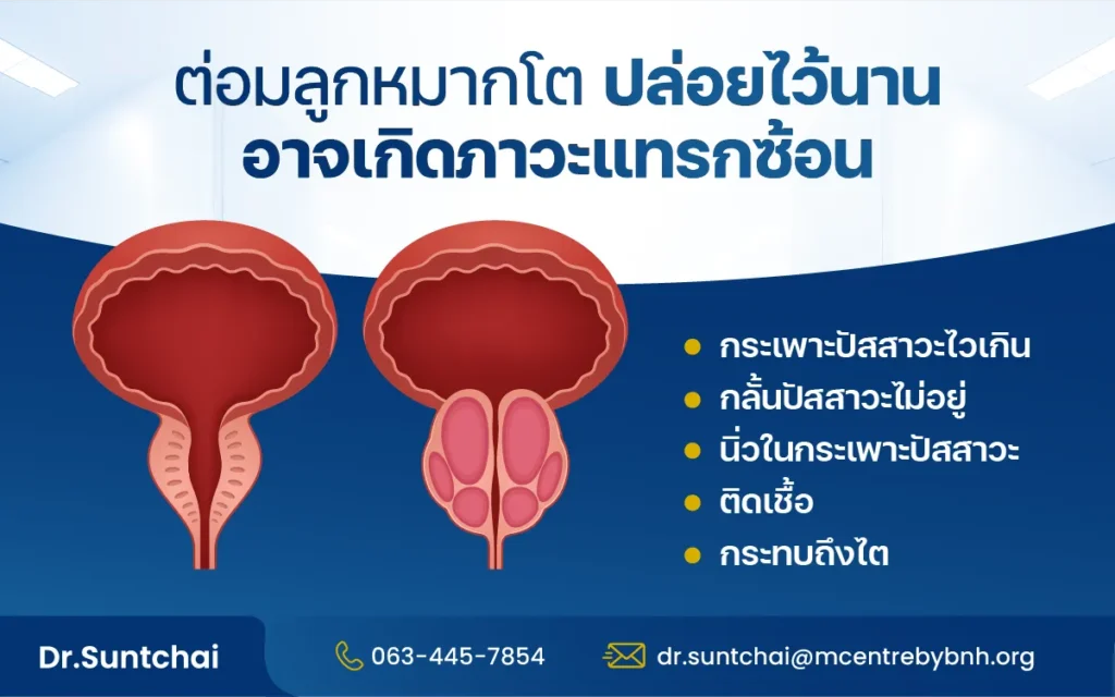 รักษาต่อมลูกหมากโตมีหลายวิธี