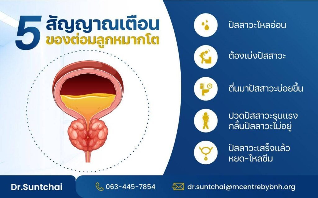 5 สัญญาณเตือนของโรคต่อมลูกหมากโต