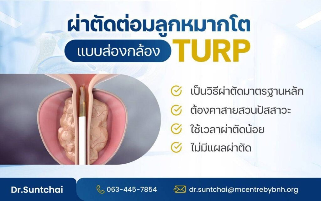 ผ่าตัดต่อมลูกหมากโตโดยการใช้กล้องส่อง (TURP)